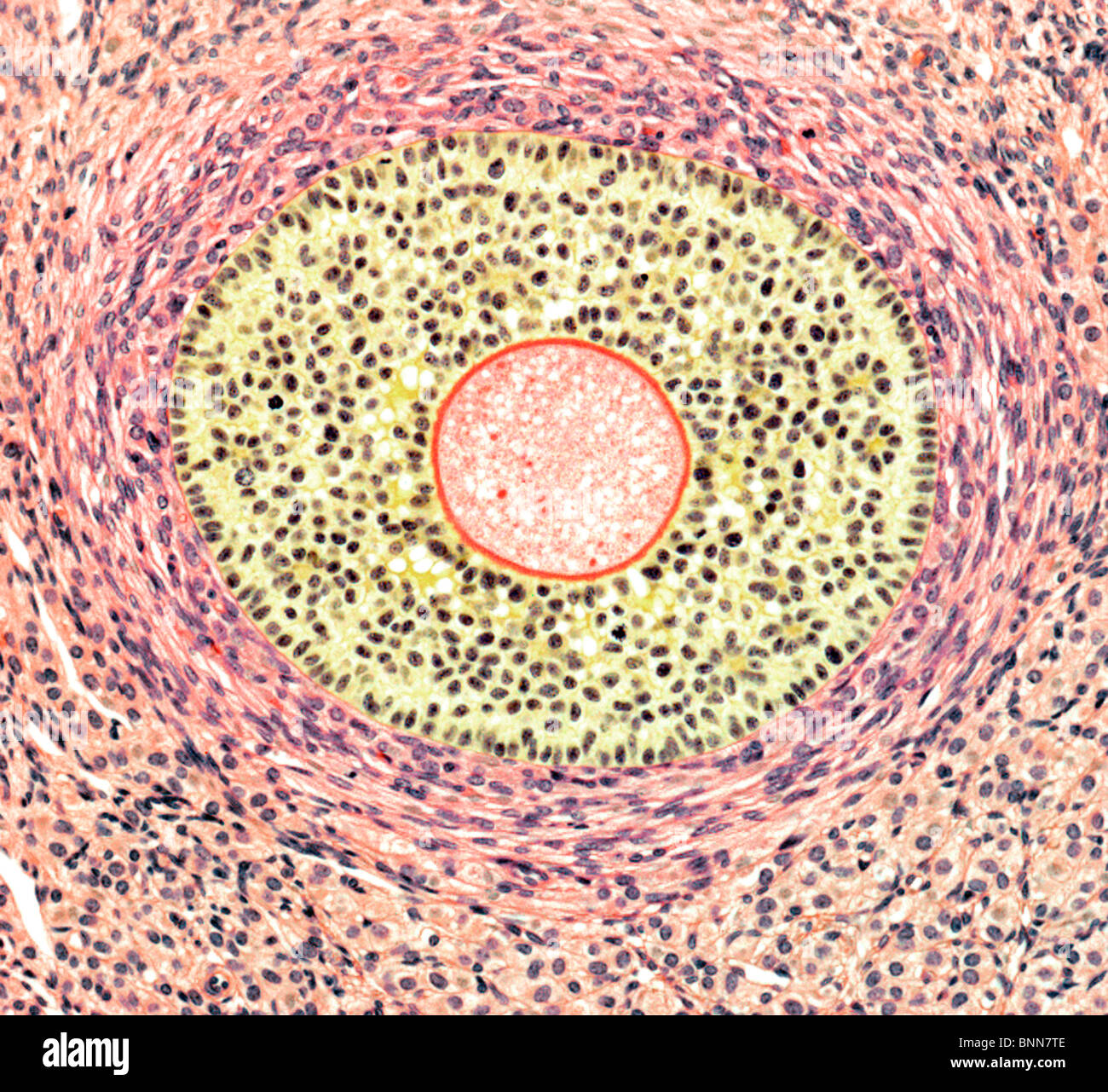 Follicolo ovarico, micrografia di luce Foto stock - Alamy